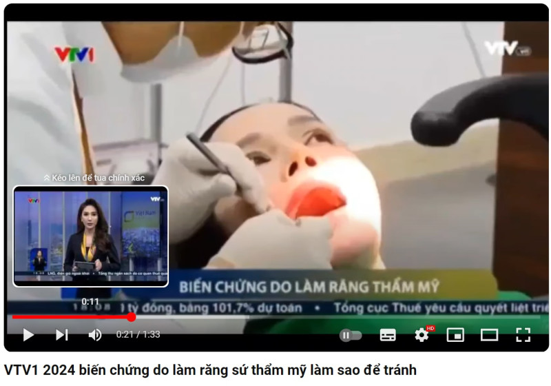 2024 biến chứng do làm răng sứ thẩm mỹ làm sao để tránh (VTV1)