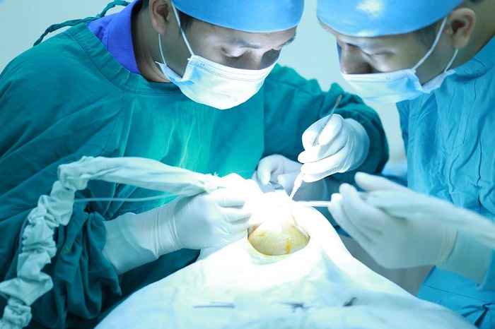 PHẪU THUẬT CẮT CHÓP RĂNG – CHO HÀM RĂNG LUÔN CHẮC KHỎE